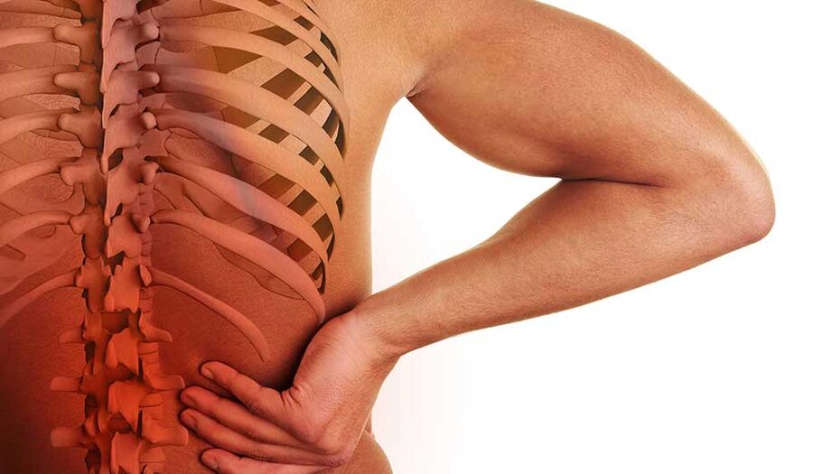 Osteocondrose da columna vertebral lumbar